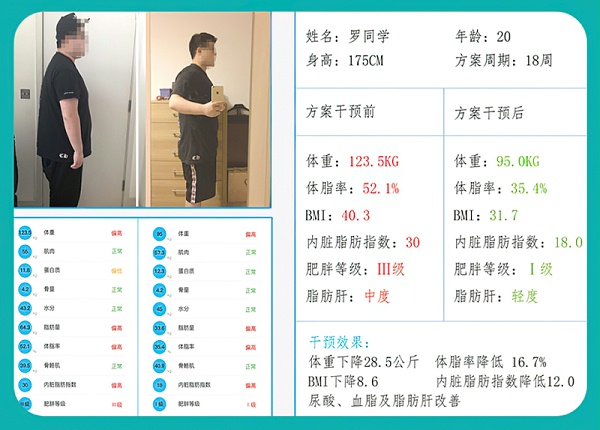 罗同学18周脂肪肝数字疗法干预：惊人减重与脂肪肝改善案例