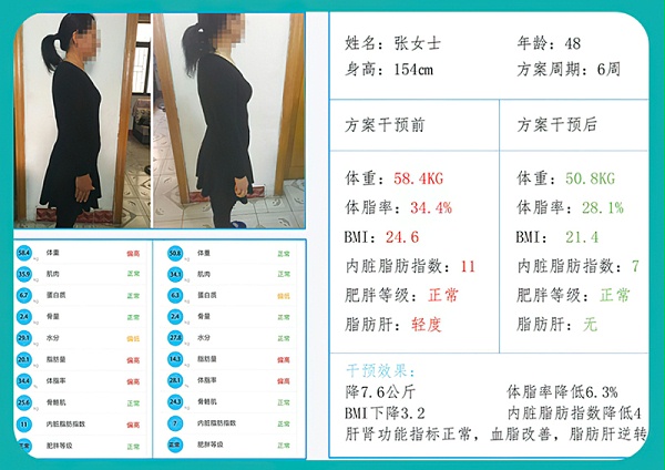 张女士的脂肪肝逆转之旅：脂肪肝纯食谱管理方案显成效